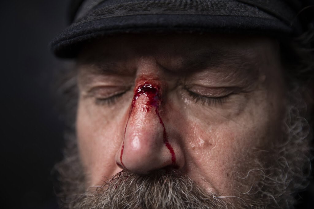 Woeful Wounds at SS Great Britain